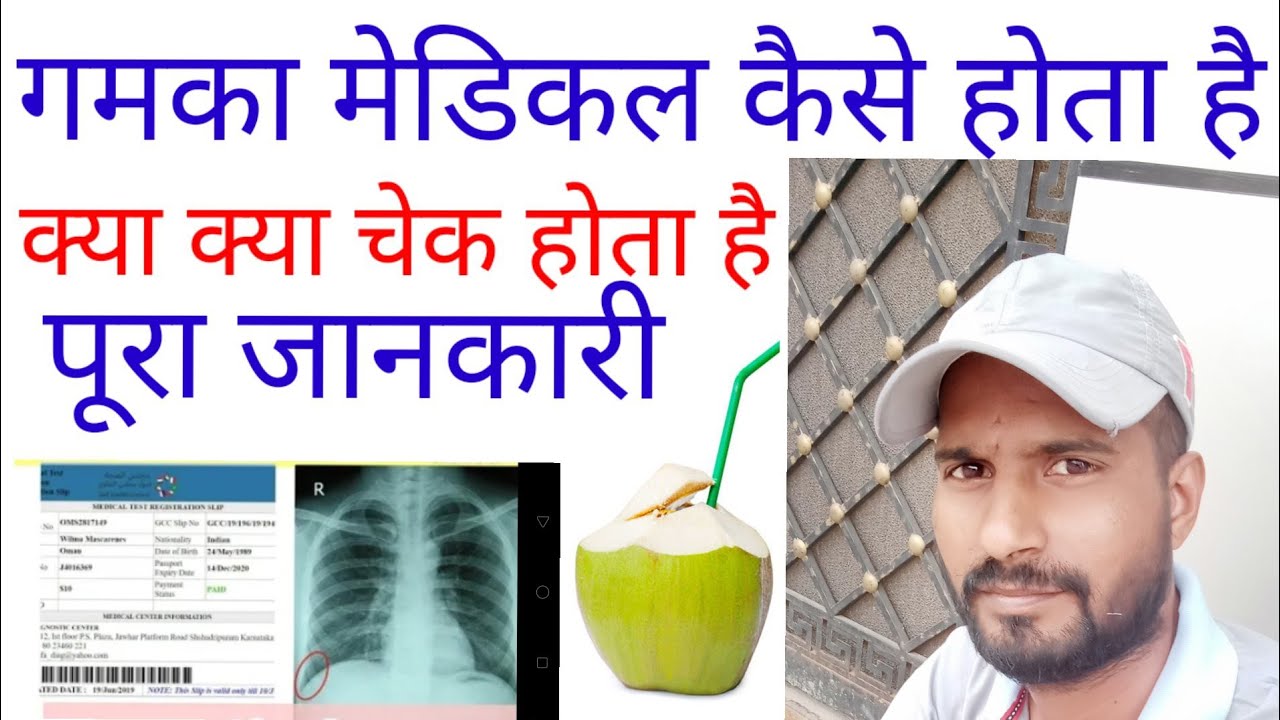 gamca medical kaise hota hai gamka medical me kya kya check hota hai