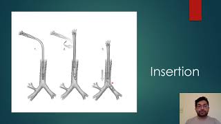 Double Lumen Endotracheal Tubes by Dhruv Solanki, MD Candidate Class of 2023