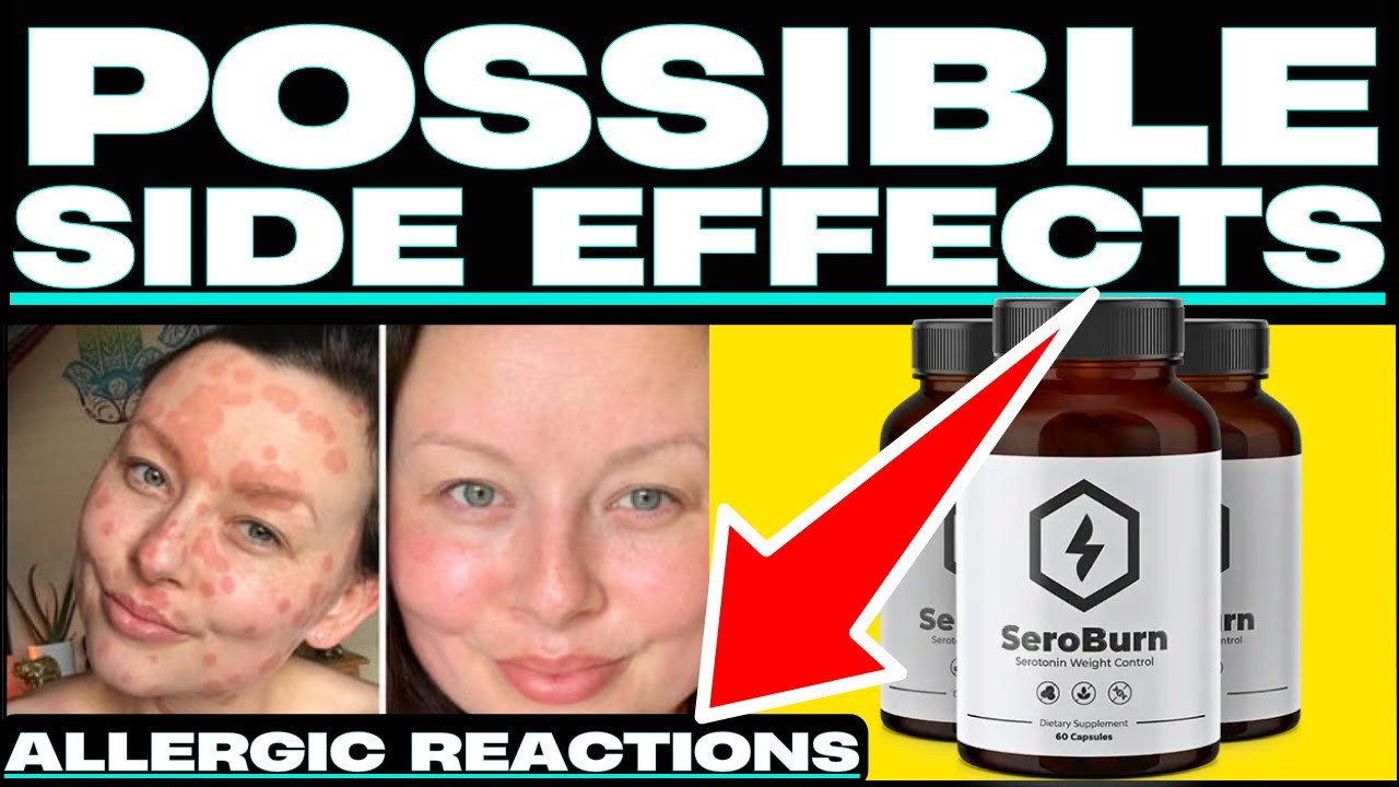 Lose weight fast? (😱❌BEWARE⛔🙀) Get Your FREE Bottle Of SeroBurn? #seroburncom
