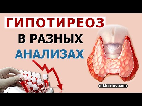 ГипоТиреоз нарушает показатели: холестерин, триглицериды, общий анализ крови, пролактин, тестостерон