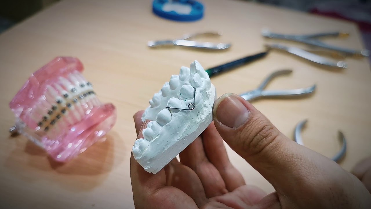 Buccal canine and single cantilever springs... نابض الدفع ونابض جر ...