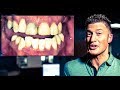 INVISALIGN, IMPLANTS, and Dental VENEERS - from PUERTO RICO for a SMILE! Cosmetic Dentistry (EP 3)