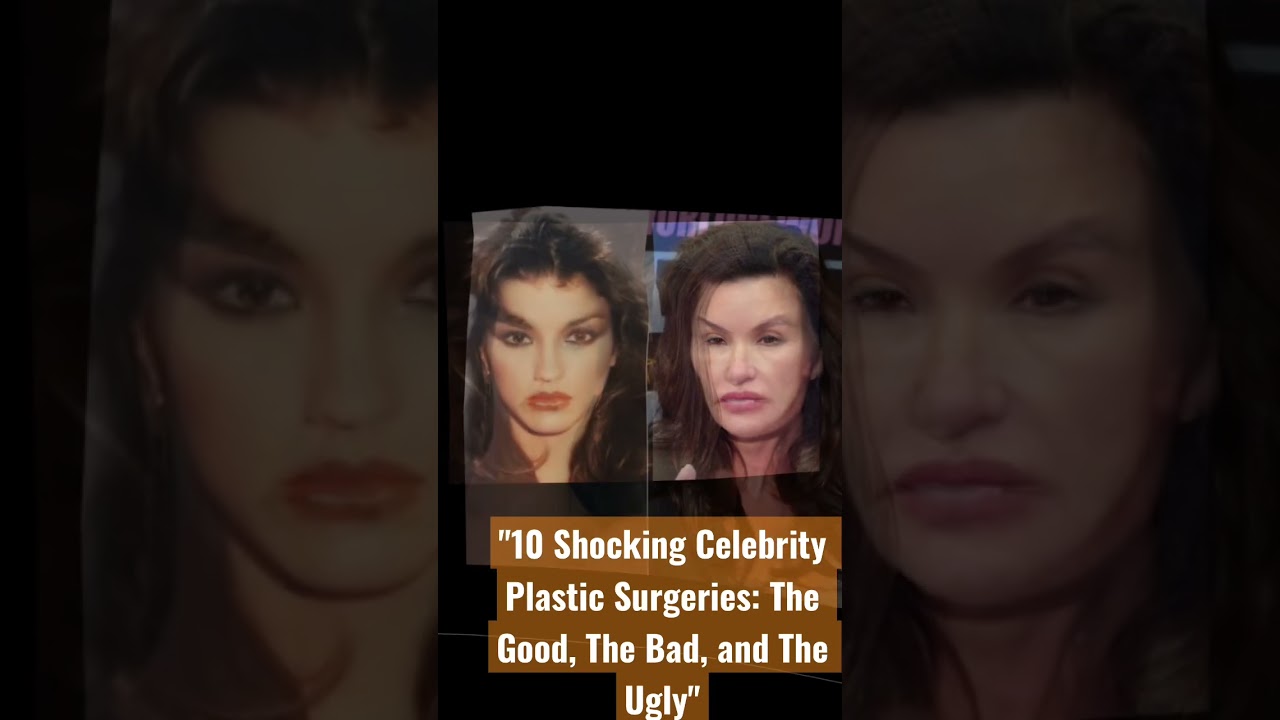 Le Shocking Celebrity Plastic Surgeries: The Good, The Bad, and The Ugly