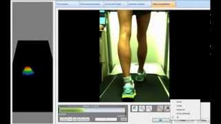 Treadmill - Patient Walking with Freestep Foot Pressure and Video Integration Software screenshot 5