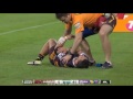 Rugby Player Dislocates His Shoulder