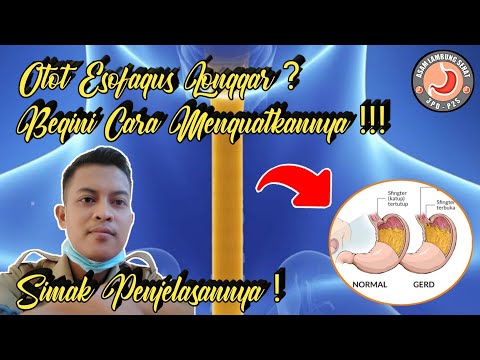 Cara Menguatkan Otot Esofagus Yang Longgar Karena Gerd