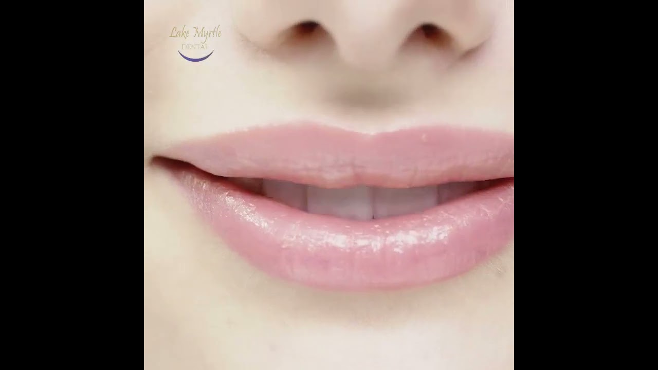 5 Benefits of Regular Dental Check-ups