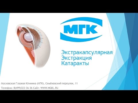 Экстракапсулярная экстракция катаракты