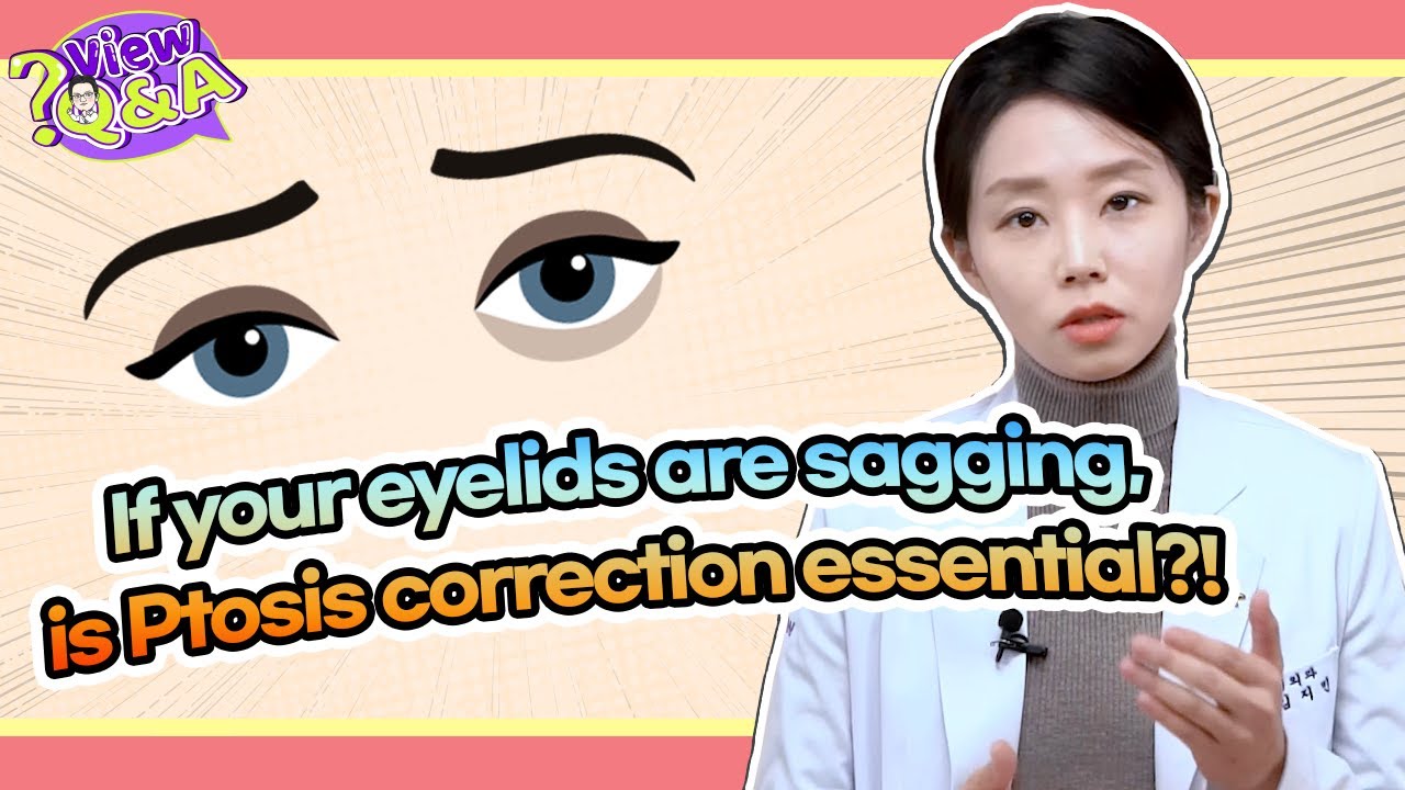 If your eyelids are sagging, is Ptosis correction essential?! 👀