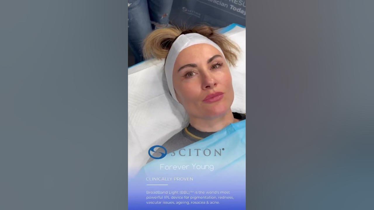 Forever Young BBL Photofacial in Chicago - YouTube