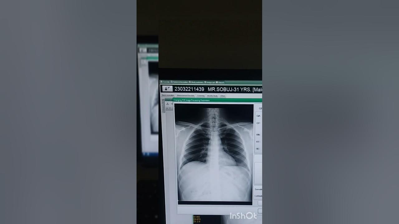 xray machine cr system fujifilm prima t2 YouTube