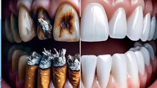 Is Harmful Know With The Expert Dentist