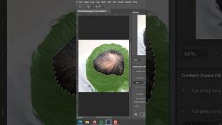 Hair Transplant using Photoshop2026#tutorial