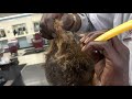 Extremely Matted Hair on Caucasian hair Removal | RESULTS