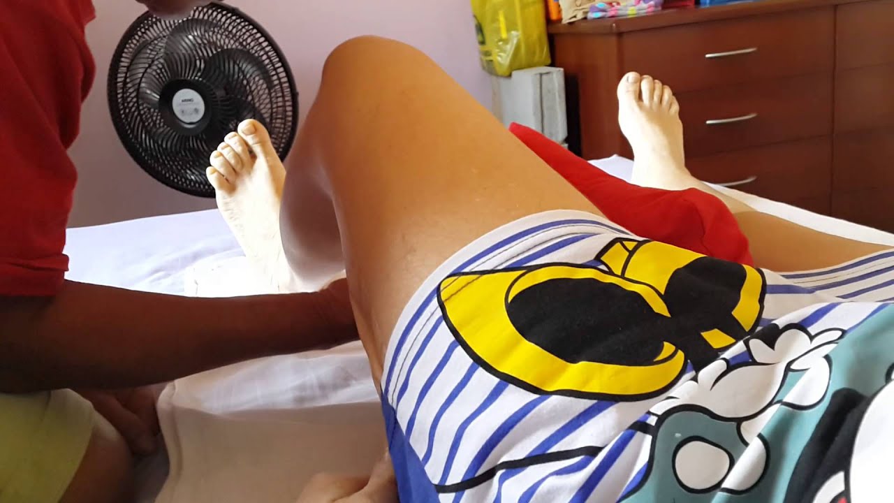 11° dia após a Artroplastia Total do Quadril. Progresso e como diminui o inchaço na coxa.