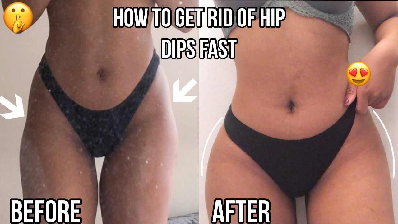 HOW TO GET RID OF HIP DIPS IN 14 DAYS