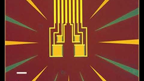 Transition edge sensor | Wikipedia audio article