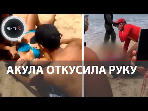 Акула откусила руку девушке в Бразилии | Видео