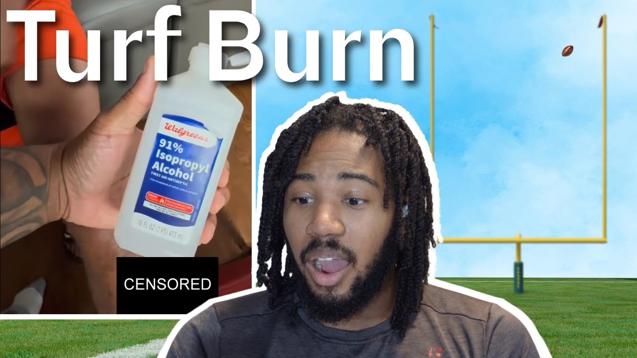 Turf Burn - Reel Review 46