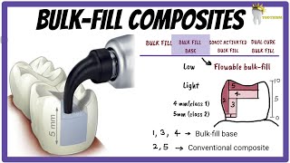 BULK-FILL Composites | How is depth of cure increased? What is SONIC ACTIVATED Bulk-fill?