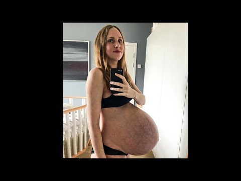 Video: Anahi Zeigt, Wie Sehr Ihr Schwangerschaftsbauch Gewachsen Ist