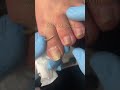 Satisfying Toenail Grooming | Gentle Foot Care Routine #fypシ #cleannails #RelaxingCare #fypシ