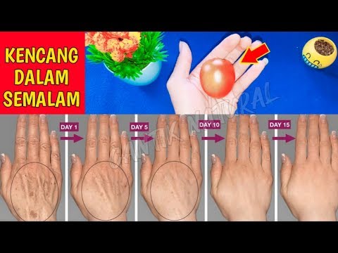 Video: Bagaimana Solek Boleh Membuat Anda Kelihatan Gemuk: 10 Contoh Bintang