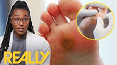 Top 3 Most Perplexing Cases Ever Doctor Shocked My Feet Are Killing Me Youtube Top 3 Most Perplexing Cases Ever Doctor Shocked My Feet Are Killing Me Youtube