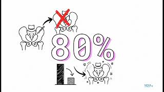 The 24-Hour Hip Replacement: Endoscopic Minimally Invasive Surgery (Endo-DAA) by Prof. Xu Jie