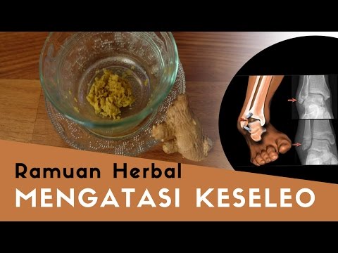 Video Obat Nyeri Sendi Akibat Terkilir Video Obat Nyeri Sendi Akibat Terkilir