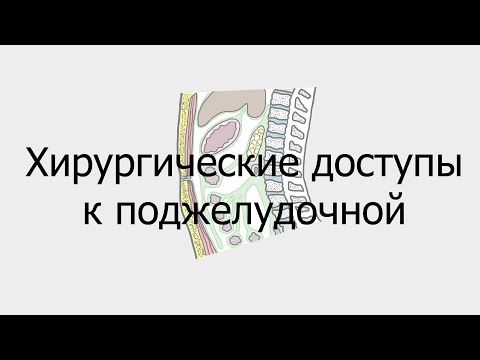 Хирургические доступы к поджелудочной железе