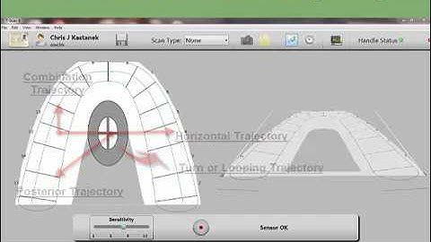 Evaluating Excursions with T-Scan: Part 2