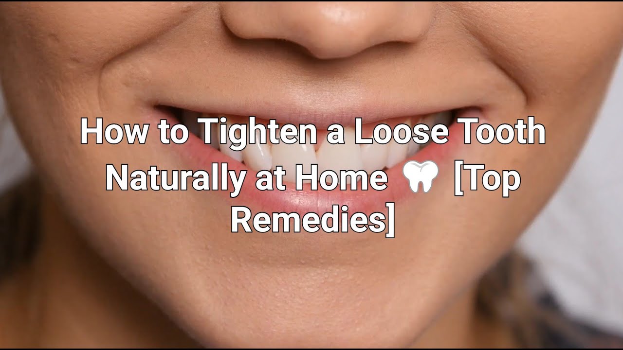 How to Tighten a Loose Tooth at Home [Top Home Remedies] - YouTube
