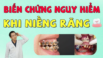 9 Biến Chứng Nguy Hiểm Thường Gặp Khi Niềng Răng | Nam Bùi Vinalign