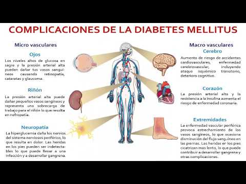 diabetes-mellitus-un-trastorno-relacionado-con-el-estilo-de-vida