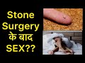 Sex After Kidney Stone Surgery? | Sex after DJ stent removal | Sex after Kidney stent removal | RIRS
