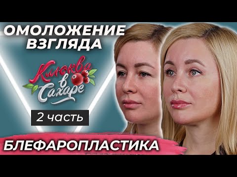 Омоложение взгляда: ИРИНА. Часть 1