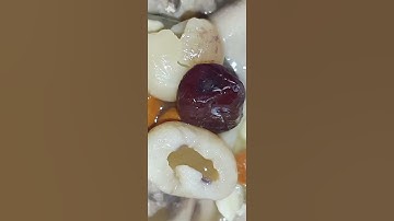 Dong Guai Chicken soup with dried red dates, Longans and Goji Berries