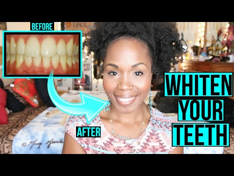 How to Whiten Teeth FAST & NATURALLY | SIMPLE Cleaning & Teeth Brushing Routine