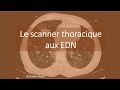 Confrence de radiologie  le scanner thoracique