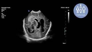 Philips ultimate ultrasound solution for paediatric assessment screenshot 2