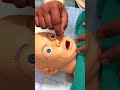 DNS (Deviated Nasal Septum) in Hindi | Complete Nursing Guide