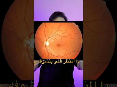بنشوف ايه لما نكشف علي عينك اكسبلور     ترند طب معلومات