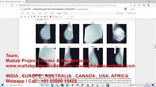 MAMMOGRAM CLASSIFICATION USING DEEP LEARNING CNN PYTHON CODE www.matlabprojectscode.com