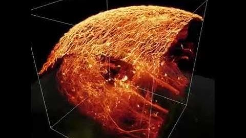 Adaptive Optics Microscopy