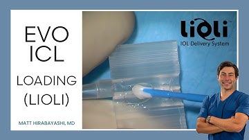 ICL Loading with Lioli (Tutorial + Tips and Tricks)