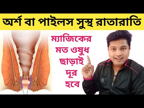 Piles Treatment Naturally | Dip Diet To Cure Piles | Bengali health Tips