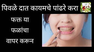 दात?कायमचे पांढरे करा,teeth? whitening home remedies in marathi, dat? white karnyache gharguti upay.