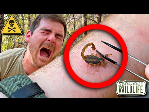 Stung By A Bark Scorpion! How Bad Is It