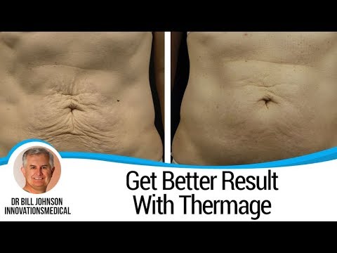 Thermage Skin Tightening Treatment Innovations Medical